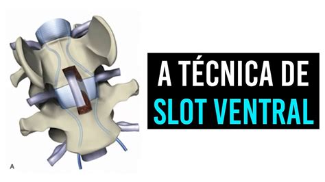 Ventral Slot De Caes